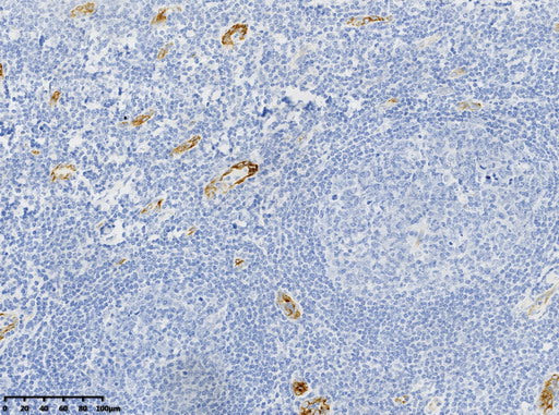Anti-von Willebrand Factor Mouse Monoclonal Antibody