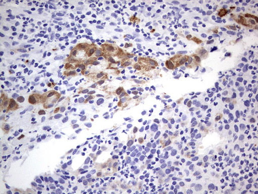 Anti-MADCAM1 Mouse Monoclonal Antibody