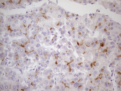 Anti-GITR Mouse Monoclonal Antibody