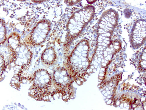 Anti-SQSTM1/p62 Mouse Monoclonal Antibody