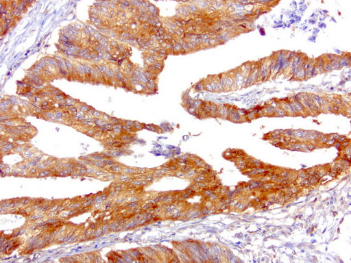 Anti-SQSTM1/p62 Mouse Monoclonal Antibody