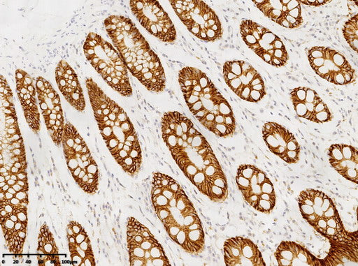 Anti-GPA33 Mouse Monoclonal Antibody
