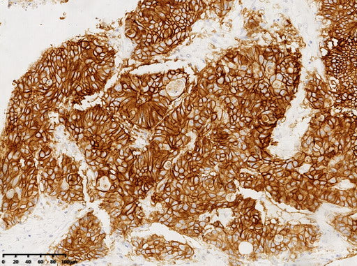 Anti-GPA33 Mouse Monoclonal Antibody