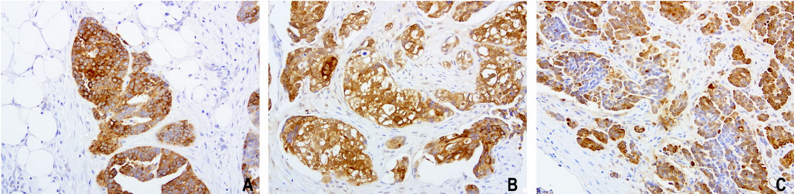 Anti-HE4 Mouse Monoclonal Antibody