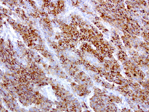 Anti-HE4 Mouse Monoclonal Antibody