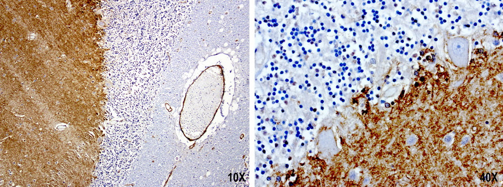 Anti-PROCR Mouse Monoclonal Antibody