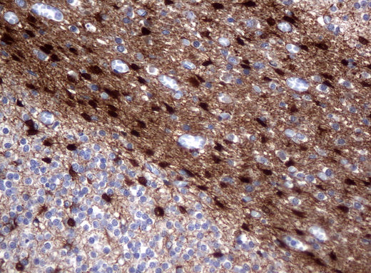 Anti-ALDH1L1 Mouse Monoclonal Antibody