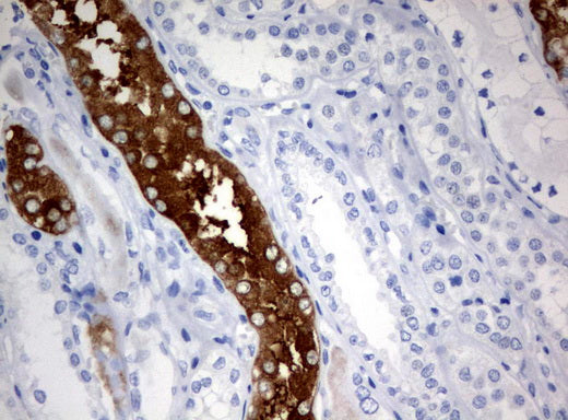 Anti-FTCD Mouse Monoclonal Antibody