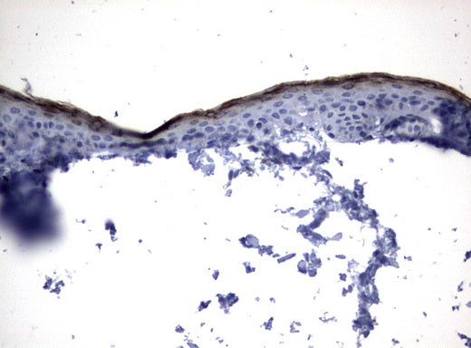 Anti-Kallikrein 8 Mouse Monoclonal Antibody