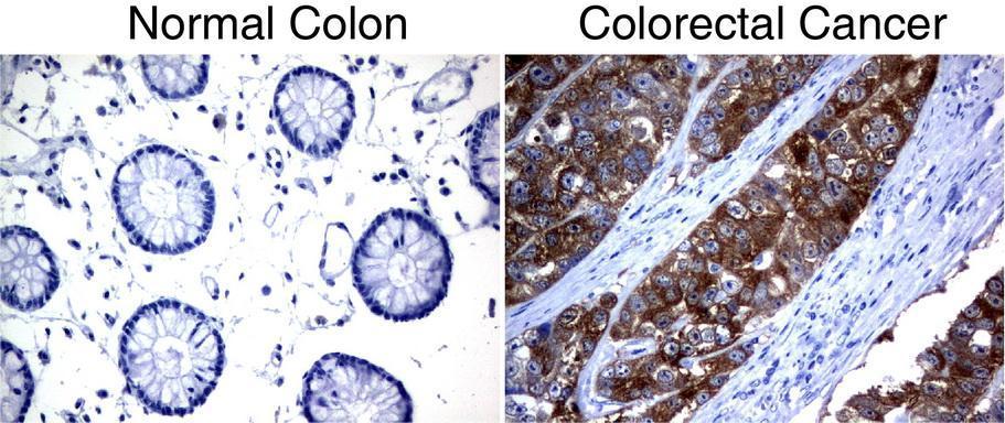 Anti-SLC7A8 Mouse Monoclonal Antibody