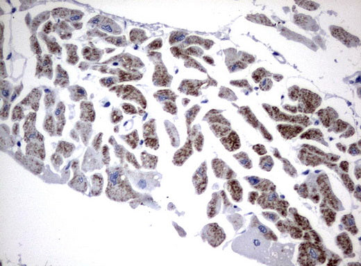 Anti-FGF21 Mouse Monoclonal Antibody