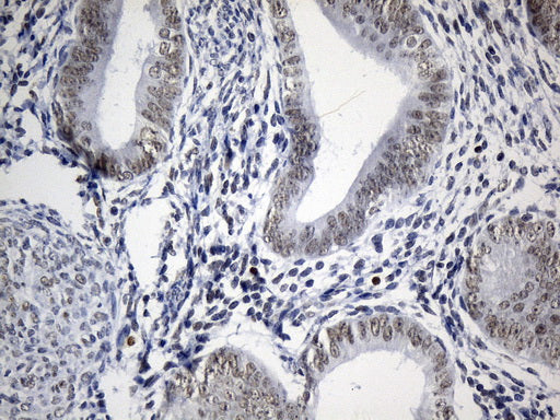 Anti-FOXP1 Mouse Monoclonal Antibody