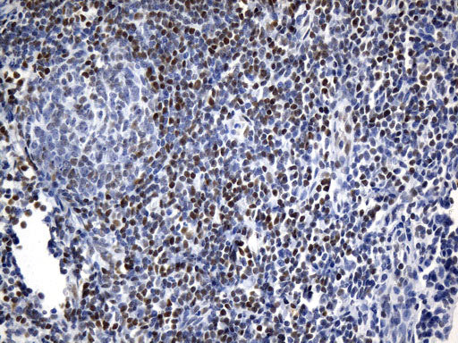 Anti-FOXP1 Mouse Monoclonal Antibody