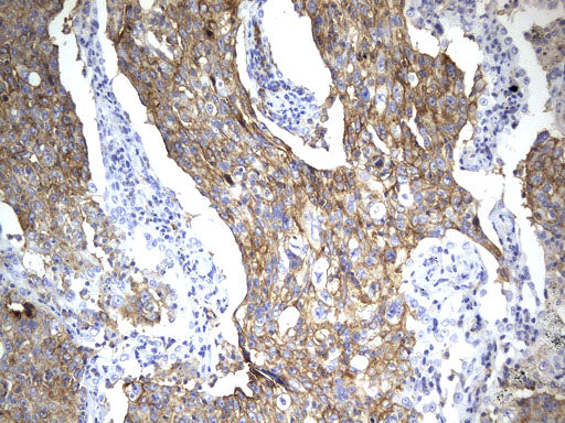 Anti-PD-L1 Mouse Monoclonal Antibody