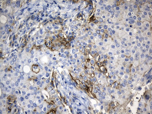 Anti-PD-L1 Mouse Monoclonal Antibody