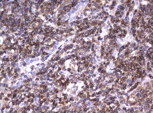 Anti-DEF6 Mouse Monoclonal Antibody