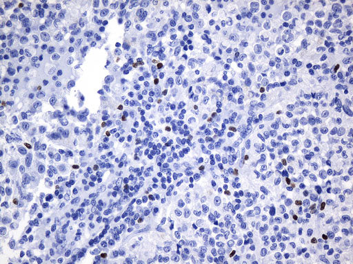 Anti-FOXP3 Mouse Monoclonal Antibody
