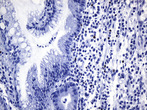 Anti-FOXP3 Mouse Monoclonal Antibody