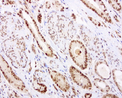 Anti-C14orf166 Mouse Monoclonal Antibody