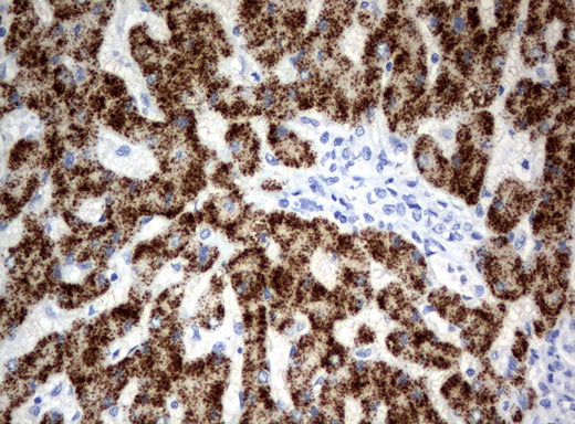 Anti-Hydroxyacid Oxidase 1 Mouse Monoclonal Antibody