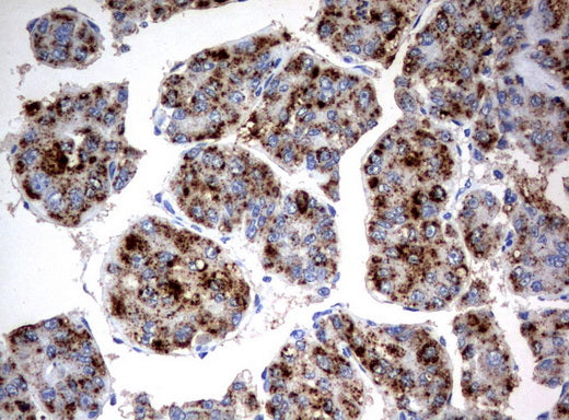 Anti-Hydroxyacid Oxidase 1 Mouse Monoclonal Antibody