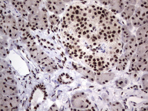 Anti-DDX56 Mouse Monoclonal Antibody