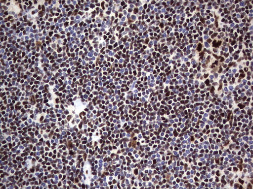 Anti-DDX56 Mouse Monoclonal Antibody