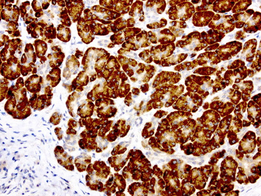 Anti-GEMIN8 Mouse Monoclonal Antibody
