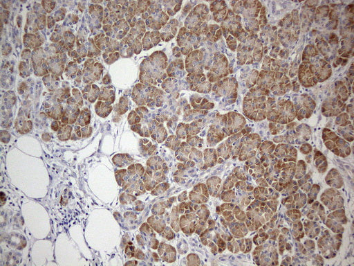 Anti-GEMIN8 Mouse Monoclonal Antibody