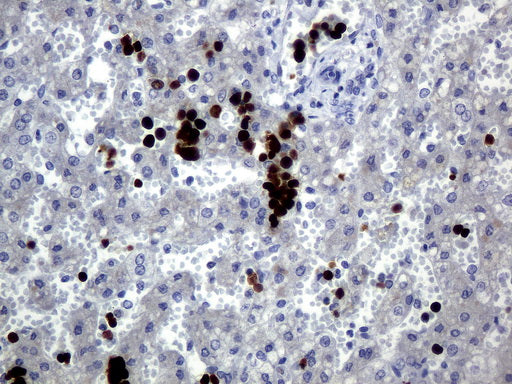 Anti-HEMGN Mouse Monoclonal Antibody