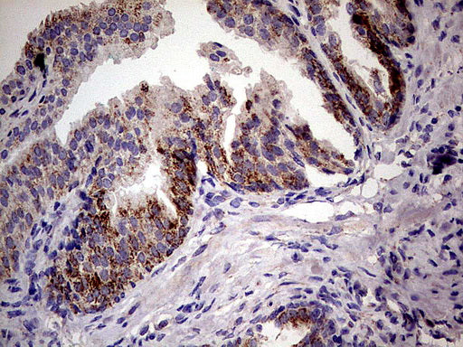 Anti-PDSS2 Mouse Monoclonal Antibody