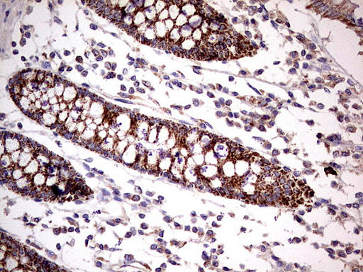 Anti-PDSS2 Mouse Monoclonal Antibody