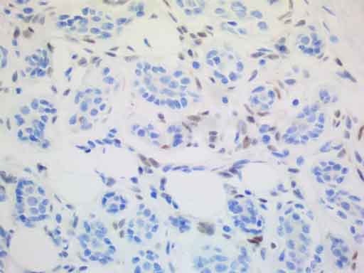 Anti-ALX4 Mouse Monoclonal Antibody