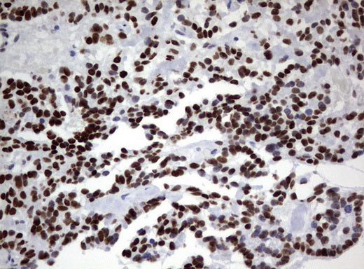 Anti-ZSCAN18 Mouse Monoclonal Antibody