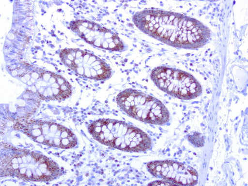 Anti-MRPS34 Mouse Monoclonal Antibody