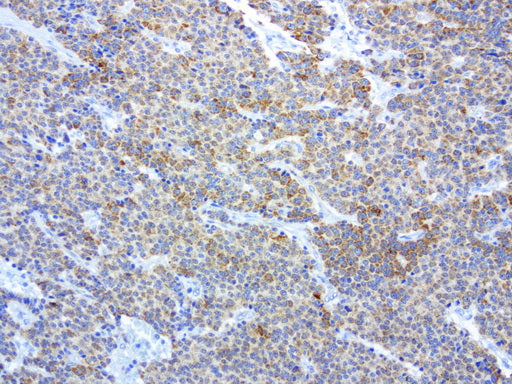 Anti-MRPS34 Mouse Monoclonal Antibody