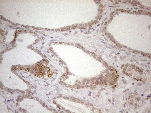 Anti-PD-L2 (PDCD1LG2) Mouse Monoclonal Antibody