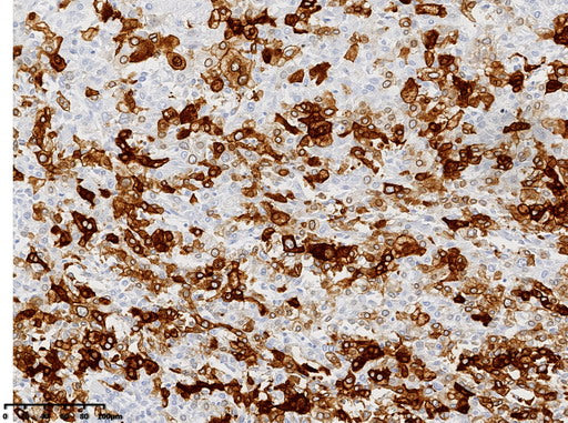 Anti-HBcAg Mouse Monoclonal Antibody