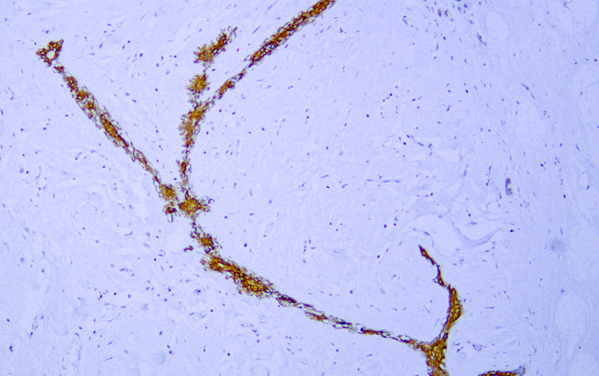 Anti-Cytokeratin pan Mouse Monoclonal Antibody