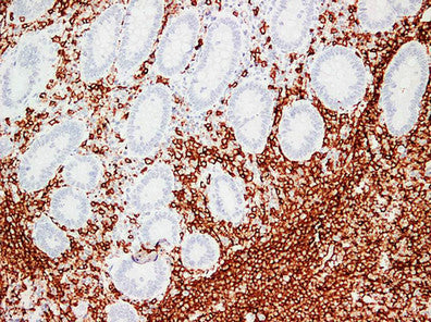 Anti-CD20 Mouse Monoclonal Antibody