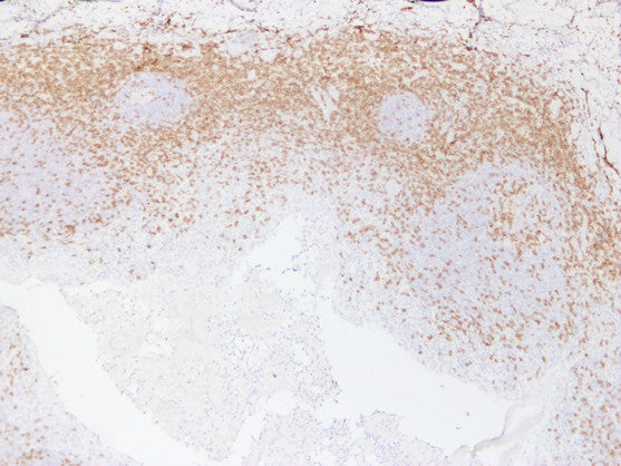 Anti-CD3eMouse Monoclonal Antibody