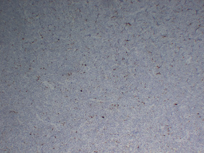 Anti-CD68 Mouse Monoclonal Antibody
