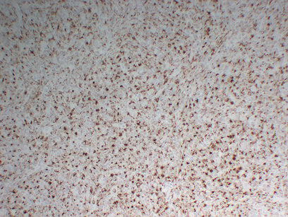 Anti-CD68 Mouse Monoclonal Antibody