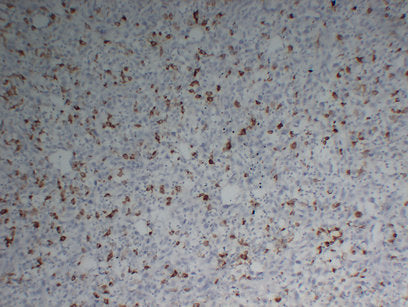 Anti-CD68 Mouse Monoclonal Antibody