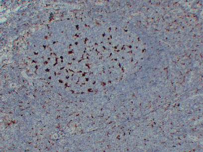 Anti-CD68 Mouse Monoclonal Antibody
