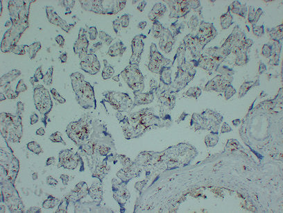 Anti-CD163 Mouse Monoclonal Antibody