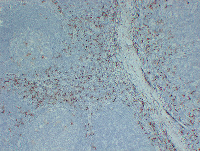 Anti-CD163 Mouse Monoclonal Antibody