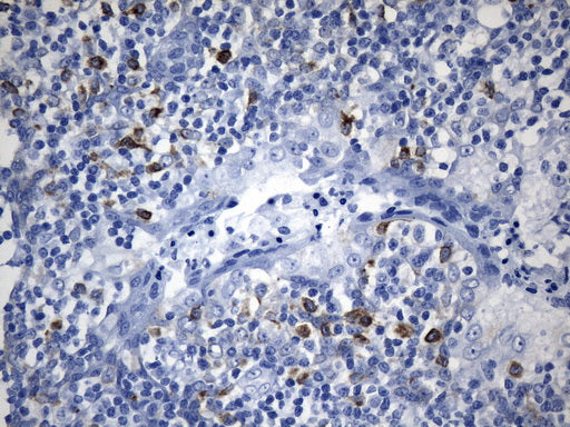 Anti-CTLA4 Mouse Monoclonal Antibody