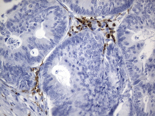 Anti-CTLA4 Mouse Monoclonal Antibody