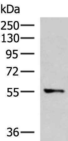Anti-Tektin 5 Rabbit Polyclonal Antibody